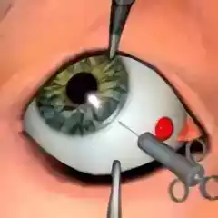 眼科手术安卓免费版